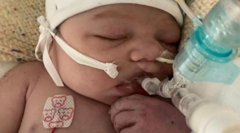 Ava-Lea resting with medical equipment attached.