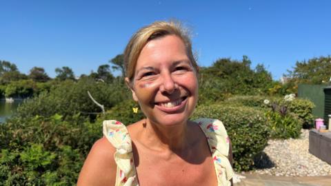 Close-up outdoor portrait of Tracy Giles who has blonde hair which is tied back. She is standing in a garden and has visible bruising beneath one eye.