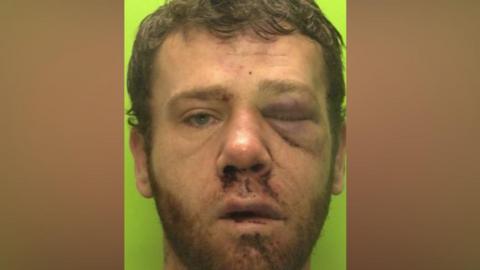 Police mugshot of an injured man