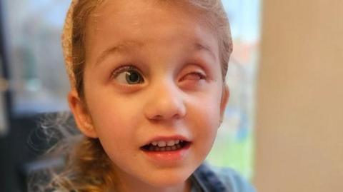 Close-up of Ella, who has one blue eye and is looking to the right. The other eye is white and there is no retina. She is wearing a headband over her blonde-brown hair, which is tied back in a low ponytail, and a denim top.