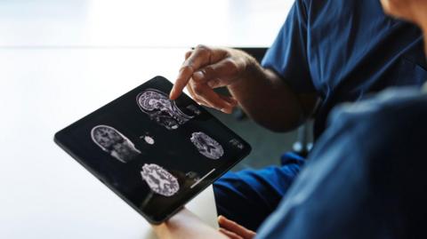 Stock photo of two people looking at brain scans on an iPad. Only the people's shoulders and hands are in view. They are wearing dark blue surgical scrubs. One is pointing at one of the four black-and-white brain scans on the screen.