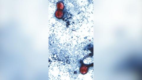 A close up picture of a parasite