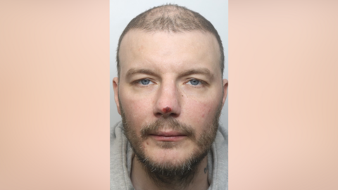 A headshot of a man wearing a grey hoodie. He has thinning hair, blue eyes, facial hair and a cut on his nose.
