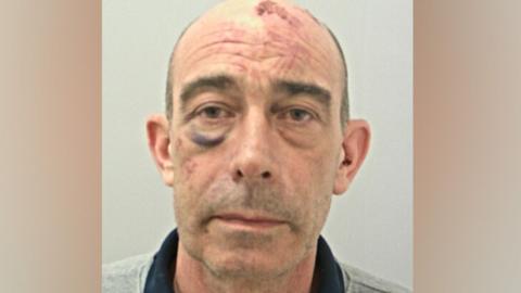 Andrew Thomson's mugshot: he has short hair, balding on top and has a black eye and injury marks on his face and top of his head