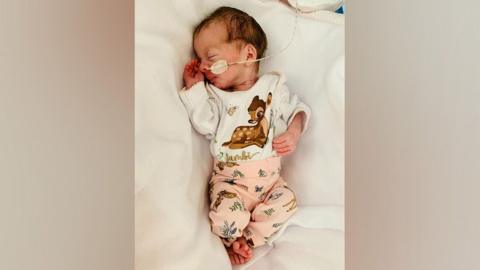 Image shows a small baby wearing a Bambi top and pale pink trousers, she has a feeding tube up her nose and is on a soft white blanket