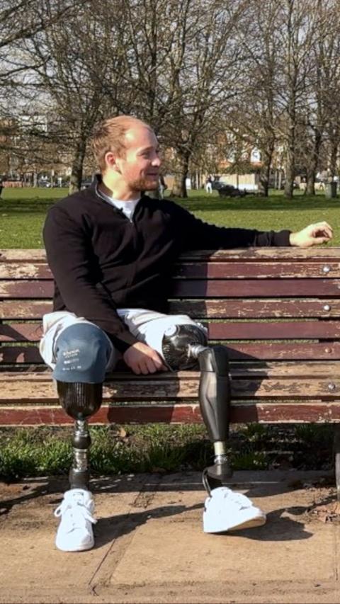Young man sat on park bench with two prosthetic legs 