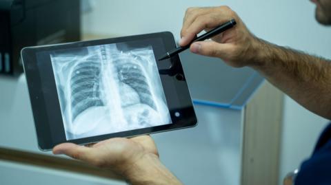 Medical professional holds a tablet showing an X-ray of a pair of lungs