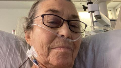 an older woman wearing glasses stares resolutely at the camera from a hospital bed, with medical tubes around her neck and a breathing tube in her nose