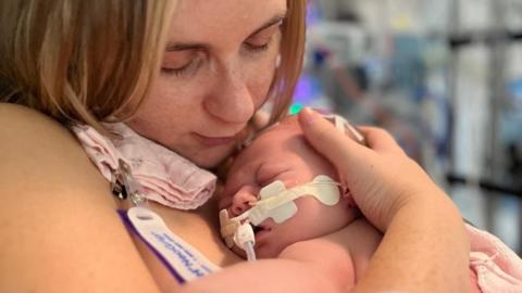 Victoria Gillibrand, who has blonde hair, looks at her newborn baby who is resting on her chest. The baby has a tube inserted into her nose and mouth. 