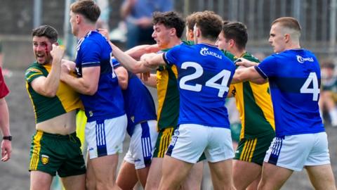 Ryan McHugh points to his cut eye during a flare-up at the end of the opening half