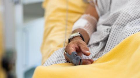 A close-up of a person's arm and hand, as they lie on a hospital bed in a white gown and on a yellow sheet. They are wearing a watch.