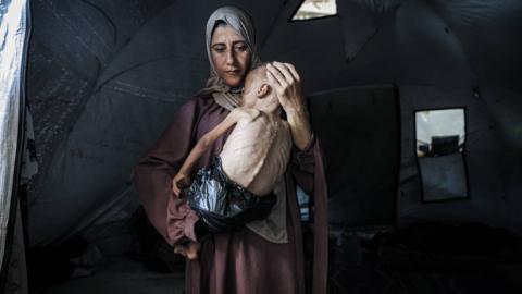 A woman holds a baby boy whose back is visibly malnourished. You can see the outline of his ribs, spine and bones protruding through his skin.