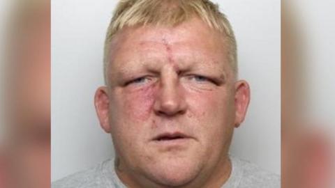 Glynn Leedell has short blonde hair and has a visible red scar on his forehead and what appears to be bruising beneath his right eye.