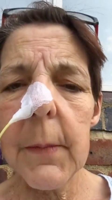 A woman with brown hair with a tube attached to her nose.