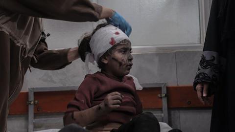 An injured Palestinian girl has her head bandaged at al-Shifa hospital in Gaza City following an Israeli strike (19 November 2025)