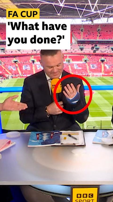Wayne Rooney looks at his injured hand