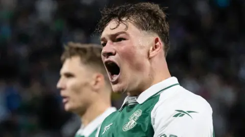 Hibs