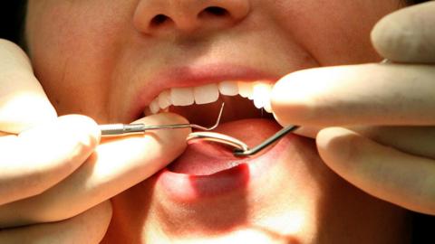 An open mouth. There are hands with gloves on over the mouth holding dentist equipment.