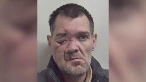 A custody image of a man with short black hair. He is looking into the camera and is stood in front of a grey background. The right side of the man's face has significant scarring, and his eye is closed.