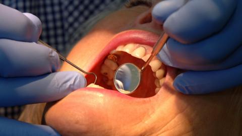 A dentist checking condition of a patient's teeth.