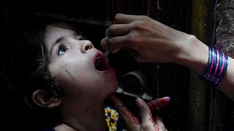 A health worker administers polio vaccine drops to a young girl during a polio vaccination campaign in Karachi on June 3, 2024.