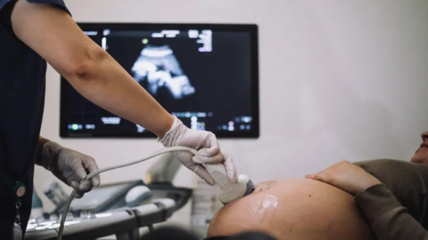 A woman is undergoing a pregnancy scan in hospital - her pregnant stomach is visible, and the arm of the medic, with a screen behind them