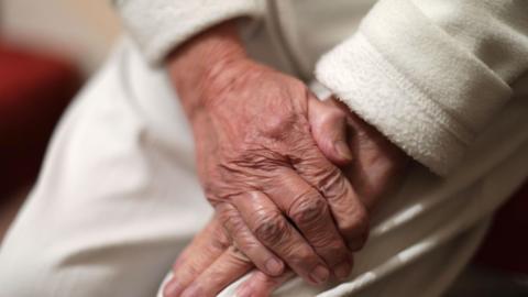 A woman with wrinkly hands placed on her lap.