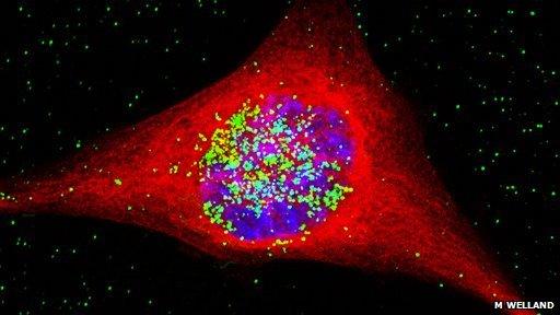 A cancer cell containing very small particles of gold (coloured green)