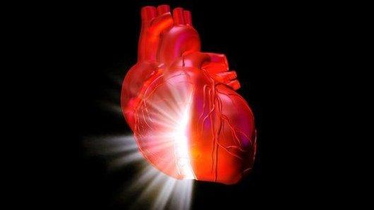 Heart attack, art work