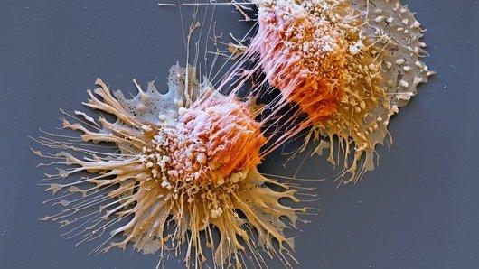 Dividing cancer cell