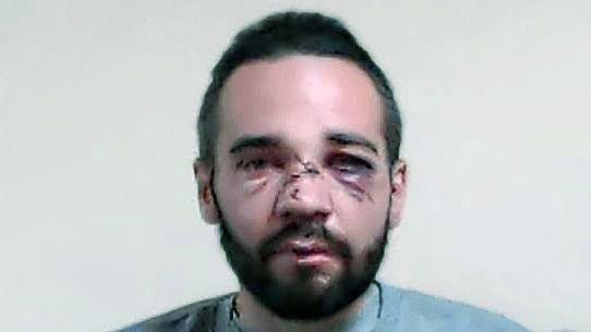 Finlay MacDonald is pictured in a police mugshot. He has short hair, and injuries to his face.