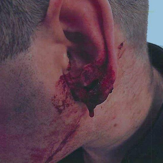 The officer's injured ear