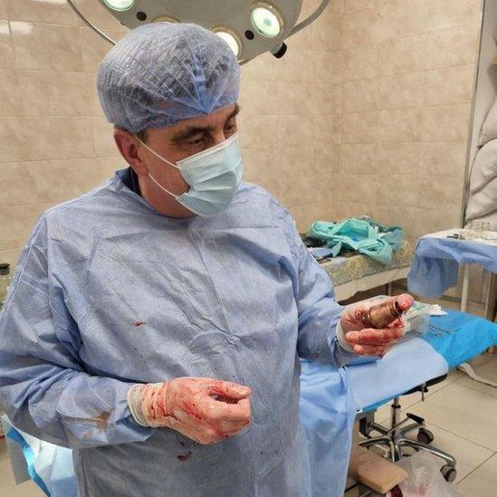 Surgeon Andrii Verba holds the grenade after the surgery