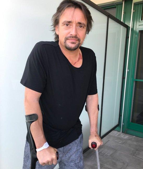 Richard Hammond