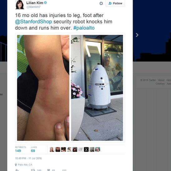 Image of leg injury and security robot