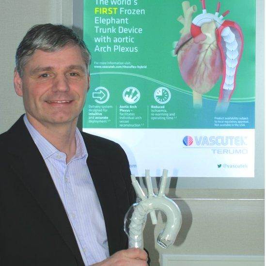 Paul Holbrook, president and CEO of Vascutek, with a Thoraflex Hybrid model