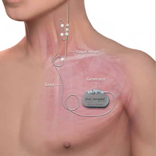 Implant diagram