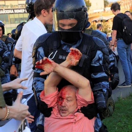 A bleeding rally participant is held by police in Moscow. Photo: 27 July 2019