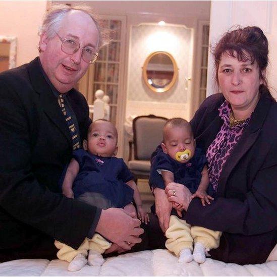 Judith and Alan Kilshaw with the twins