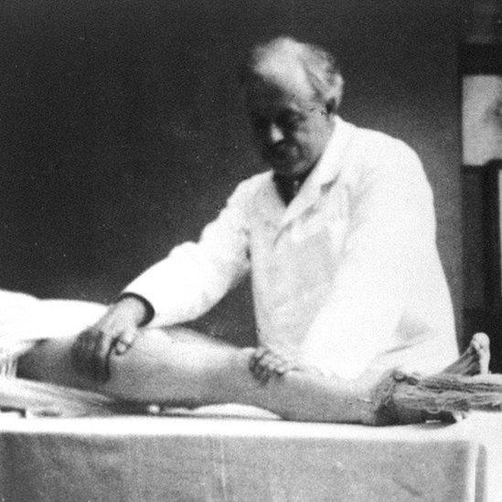 Robert Jones demonstrating Thomas splint