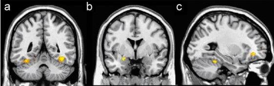 Functional MRI scans from the research