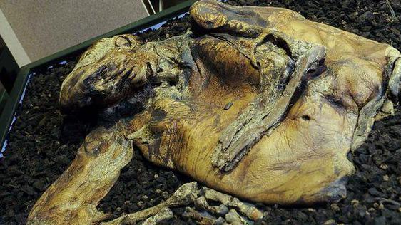 The head and upper torso of the Lindow Man, with leathery, tan skin and remnants of his hair and beard still attached. 