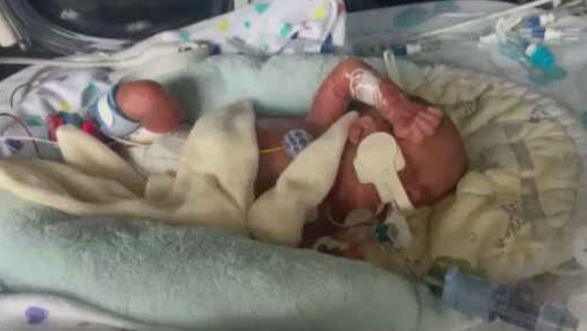 Clark Geddes - baby lying in incubator with medical equipment around and attached to him