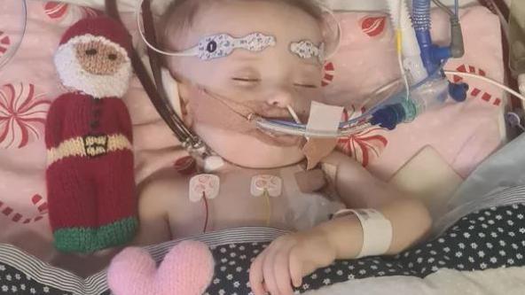 Penelope a 14-month-old girl in hospital bed with tubes going into her mouth and neck and a knitted toy santa on her pillow