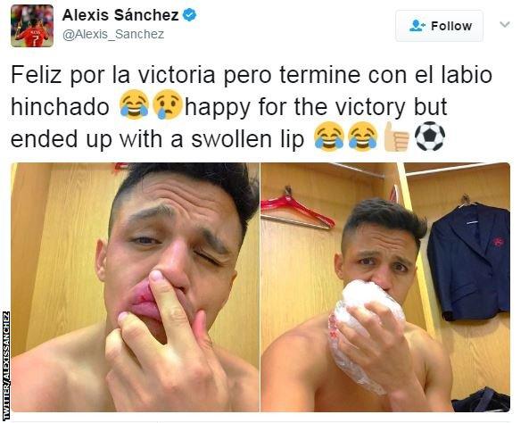 Alexis Sanchez