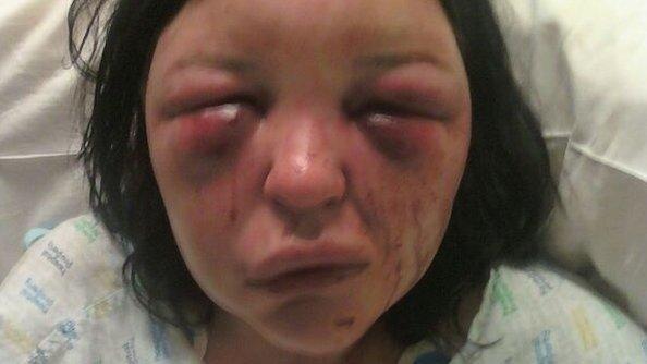 Domestic abuse victim