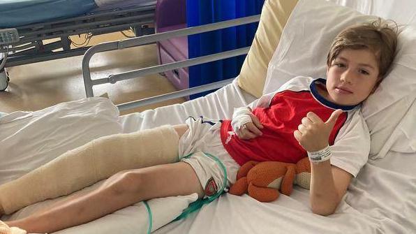 A young boy with blonde hair, wearing a red and white t-shirt and white shorts. He is lying on a hospital bed with his right leg in a bandage and he has his thumb up.