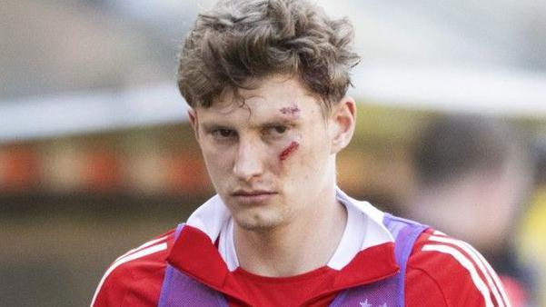 Aberdeen footballer Jack McKenzie with injured face.