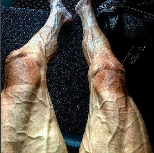 A picture of Pawel Poljanski's legs, captioned: "After sixteen stages I think my legs look little tired."