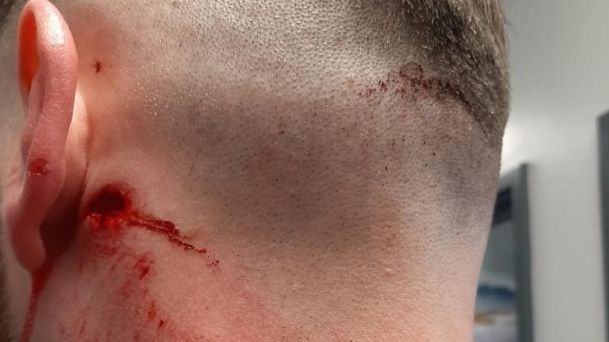 Back of police officer's head containing a large bloody gash behind his ear